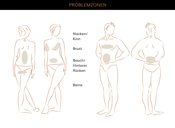 Problemzonen, Plastische & Ästhetische Chirurgie München, AEZM